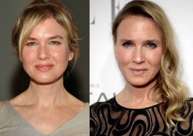 Renée Zellweger, antes y después de operarse. 