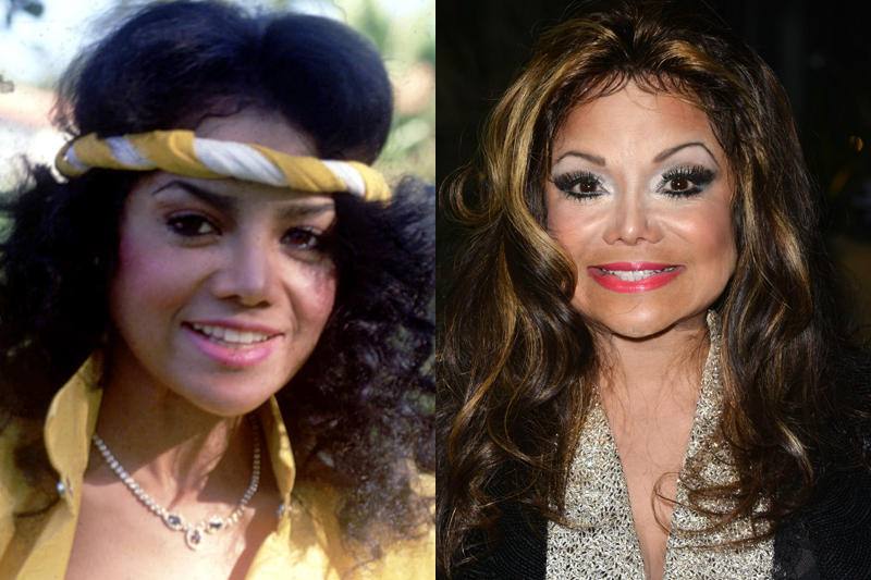 La Toya Jackson antes y después de operarse. 