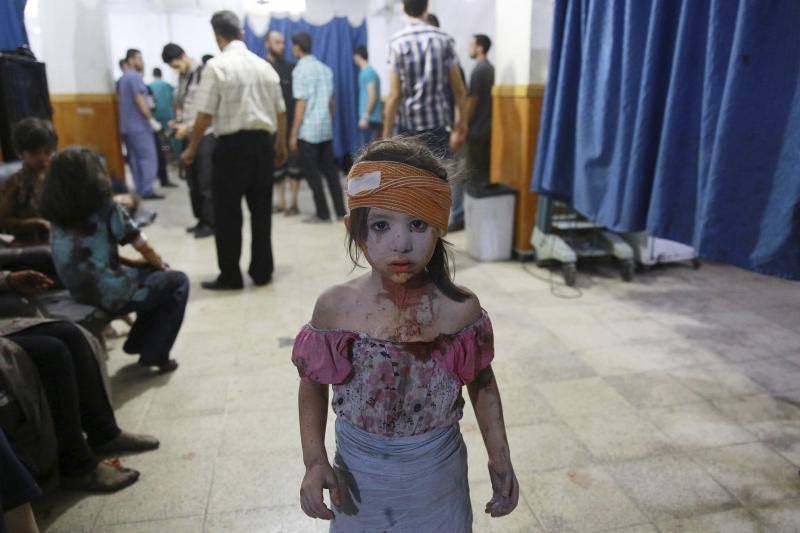 Segundo premio en Temas de Actualidad. La fotografía muestra a un niña siria que ha sido atendida en un hospital en la ciudad de Douma (Siria)