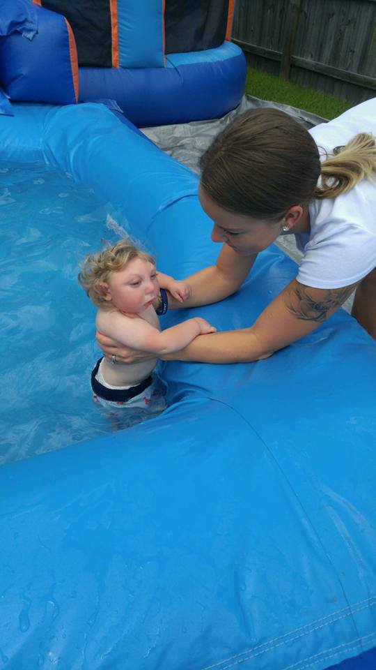 Así vive Jaxon, un niño con microcefalia