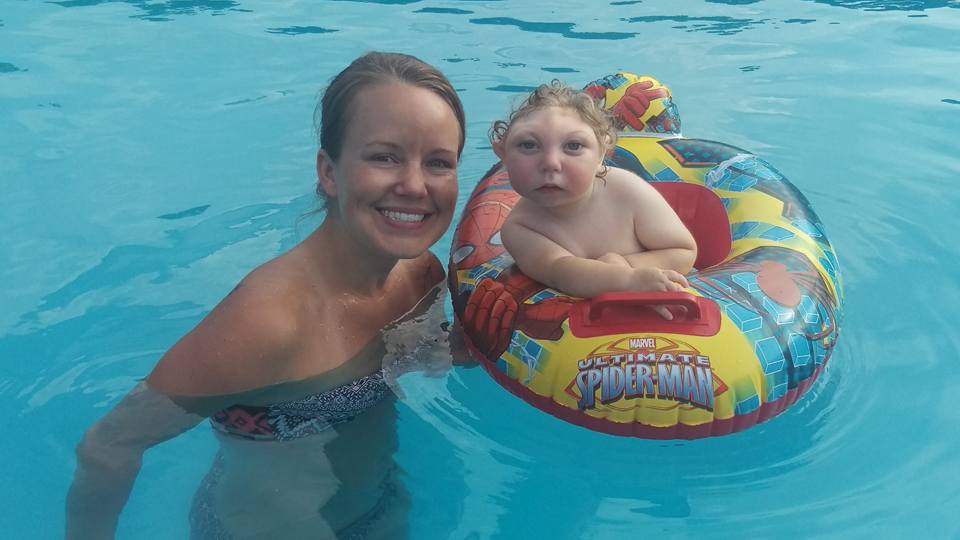 Así vive Jaxon, un niño con microcefalia