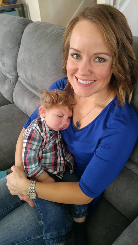 Así vive Jaxon, un niño con microcefalia