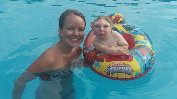 Así vive Jaxon, un niño con microcefalia