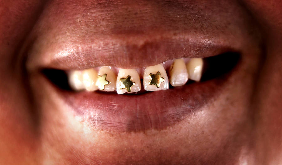 Son unos mineros que abundan en Brasil en la selva del Amazonas. Viven en condiciones infrahumanas y arriesgan su vida al utilizar máquinas como los monitores hidráulicos en búsqueda de mercurio, como sustancia para amalgamar el oro. Un uso que daña gravemente el medio ambiente.