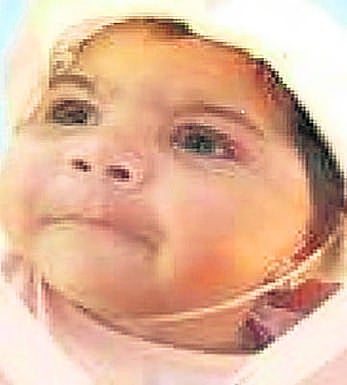 Araitz tiene un año y su tratamiento es muy costoso. E. C, 