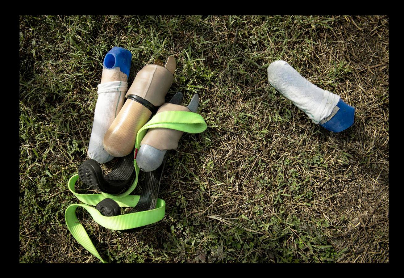 Cuando Cola era solo un cachorro, un vecino de las afueras de Bangkok (Tailandia) le amputó brutalmente las patas delanteras, a golpes de espada, porque el animal había mordisqueado sus zapatos. Gill Daley, que sufrió la amputación de las piernas como consecuencia de una infección, y su esposo John (a quien vemos en las fotografías), descubrieron por casualidad la historia de Cola, decidieron adoptar al animal en su refugio en Phuket y le adaptaron unas prótesis basadas en las palas que utilizan algunos deportistas paralímpicos. Hoy, Cola es el primer perro del mundo en usar este tipo de prótesis, pero Gill no ha podido verlo. Falleció en febrero