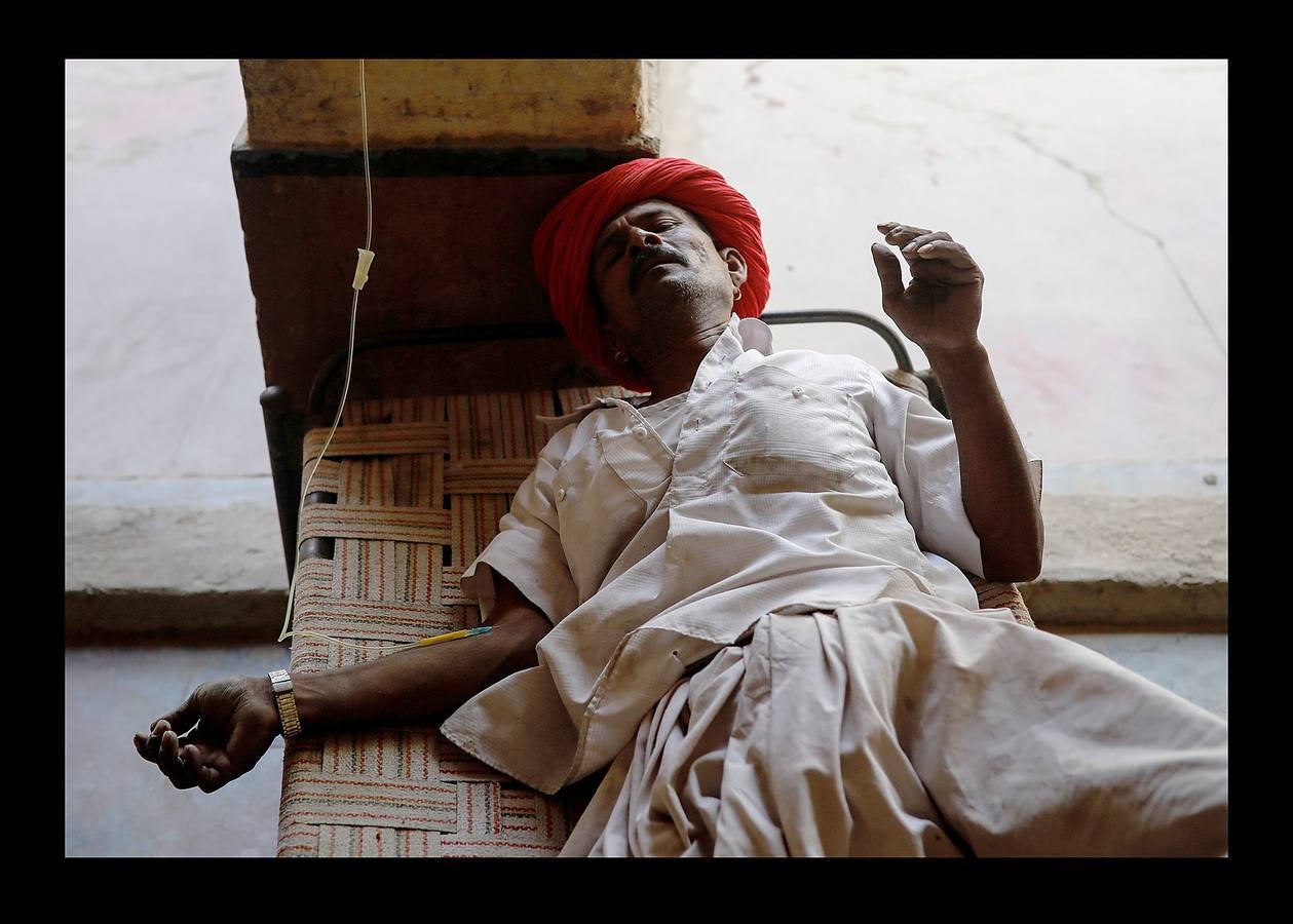 El Lifeline Express ha tratado a más de un millón de personas desde su creación, en 1991. Este tren de siete vagones, decorado con guirnaldas de flores, que atraviesa la India desde hace 27 años, se ha convertido en un verdadero hospital rodante para muchos miles de personas sin recursos. La mayor parte de los médicos son voluntarios de universidades u hospitales cercanos y, por lo general, pasan un mes en un distrito realizando cirugías que van desde cataratas y cáncer hasta hendiduras en el paladar y diversas ortopedias.