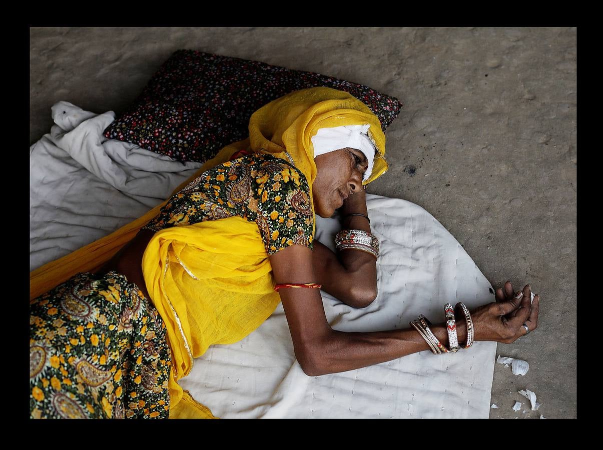 El Lifeline Express ha tratado a más de un millón de personas desde su creación, en 1991. Este tren de siete vagones, decorado con guirnaldas de flores, que atraviesa la India desde hace 27 años, se ha convertido en un verdadero hospital rodante para muchos miles de personas sin recursos. La mayor parte de los médicos son voluntarios de universidades u hospitales cercanos y, por lo general, pasan un mes en un distrito realizando cirugías que van desde cataratas y cáncer hasta hendiduras en el paladar y diversas ortopedias.