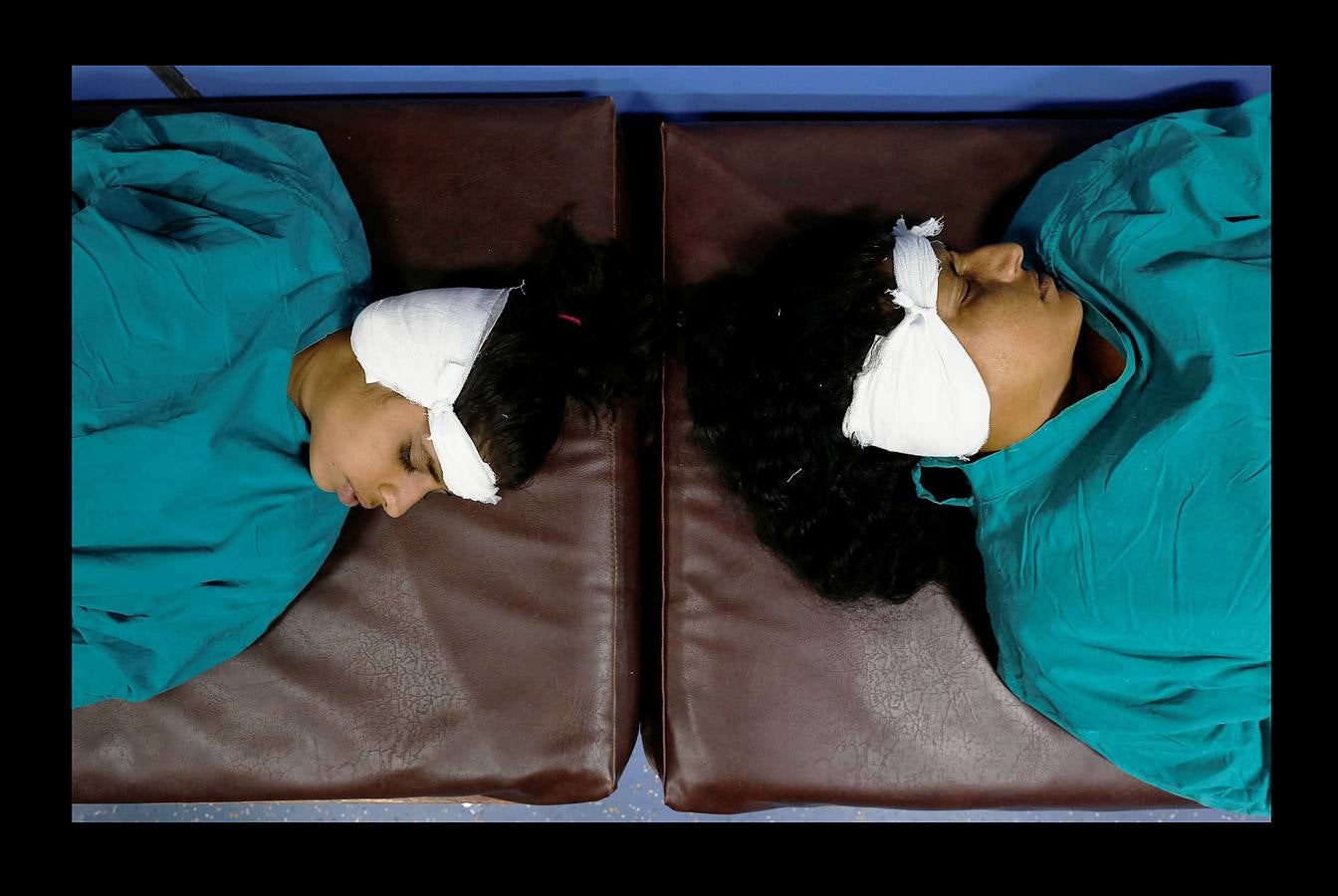 El Lifeline Express ha tratado a más de un millón de personas desde su creación, en 1991. Este tren de siete vagones, decorado con guirnaldas de flores, que atraviesa la India desde hace 27 años, se ha convertido en un verdadero hospital rodante para muchos miles de personas sin recursos. La mayor parte de los médicos son voluntarios de universidades u hospitales cercanos y, por lo general, pasan un mes en un distrito realizando cirugías que van desde cataratas y cáncer hasta hendiduras en el paladar y diversas ortopedias.