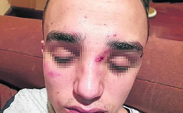 La víctima, todavía desorientado y ensangrentado, fue sometido a un TAC en el hospital.