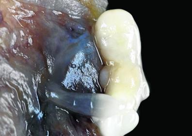 Imagen secundaria 1 - 1. Súper macro. Rostro de procesionaria del pino. La imagen se tomó apilando 85 fotos de un ejemplar anestesiado. 2. Fotografía médica. Feto humano con tan solo ocho semanas. 3. Súper macro. Tricoma de ortiga. El estudio descubrió que su secreto estaba encerrado en la ampolla apical.