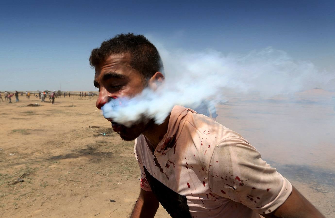 Un manifestante palestino herido tras recibir el impacto de un bote de gas lacrimógeno disparado por tropas israelíes durante una protesta. 