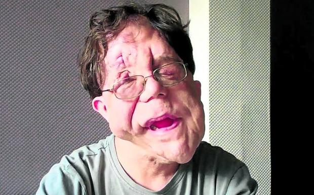 Adam Pearson, en la actualidad.