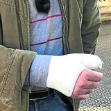 Uno de los afectados con el brazo vendado.