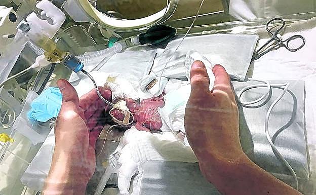 Un adulto marca con sus manos las diminutas dimensiones de la criatura, a los cinco días de nacer. 