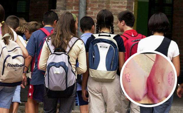 El Gobierno vasco investigará si hay más colegios donde los alumnos se retan a hacerse heridas