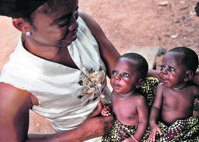Imagen secundaria 1 - Arriba, los mellizos Kehinde y Taiwo Akinbola esperan en el hospital de Igbo Ora a recibir sus vacunas. Abajo a la izquierda, Suliat Ogunjimi con sus mellizos Afusat Ganiyu y Ganiyatu Adesope, en la misma localidad nigeriana. A la derecha, Los gemelos idénticos Taiwo Ahmed y Kehinde Ahmed. 