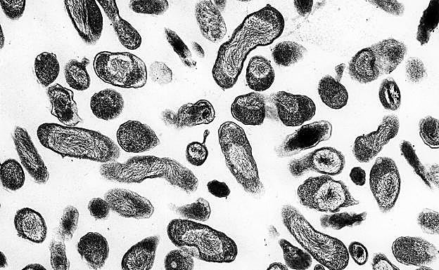 La Cloxiella burnetii, vista en el microscopio. 