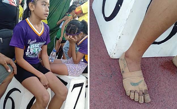 Rhea Bullos y su pies descalzos y cubiertos de esparadrapo. 