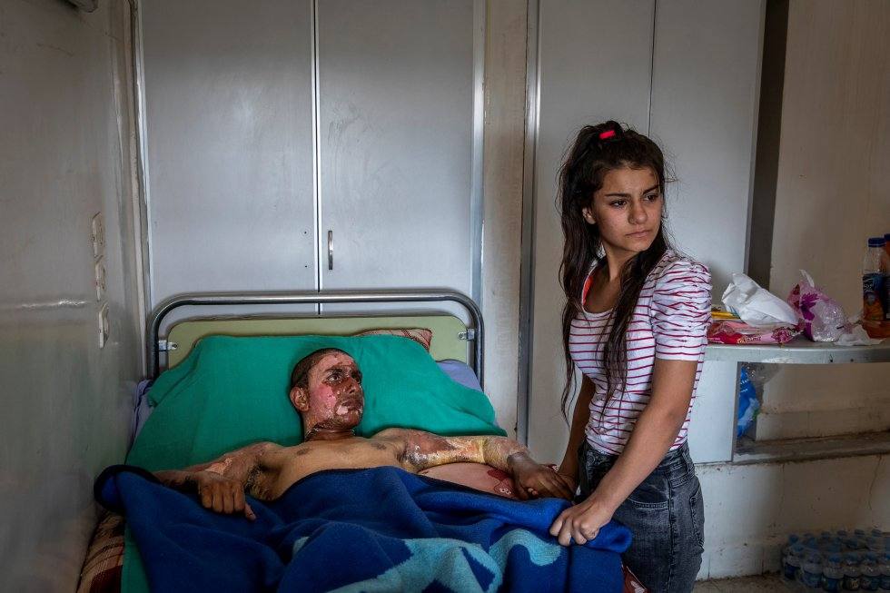 Un joven combatiente kurdo-sirio gravemente herido, que recibe la visita de su pareja por primera vez desde que está hospitalizado.