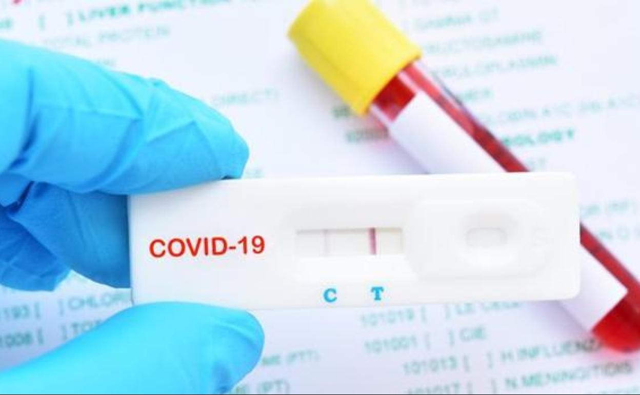 Un test más rápido que la PCR y sin laboratorio