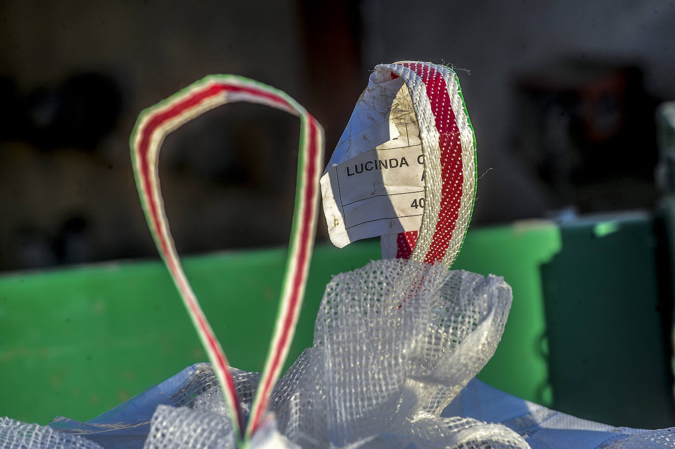 Fotos: Nacerán y se llamarán Monalisa y Lucinda