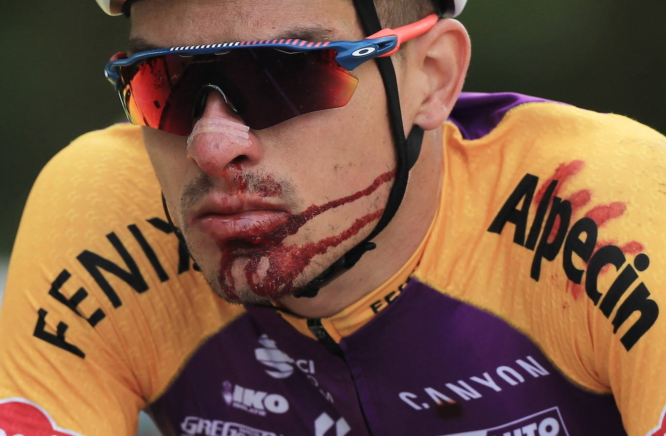 Fotos: Dos graves caídas, una provocada por una aficionada, protagonizan la primera etapa del Tour de Francia