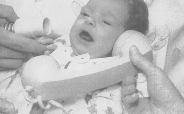 Stefany Fae, horas después del trasplante al que fue sometida en 1984.. 