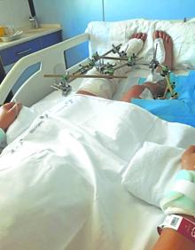 Imagen secundaria 2 - Abajo a la izquierda, Ángela, en una foto cedida por la familia; a la derecha, las heridas que le ha provocado el atropello; y, arriba en el centro, estado en el que quedó el coche junto a la discoteca Fever. 