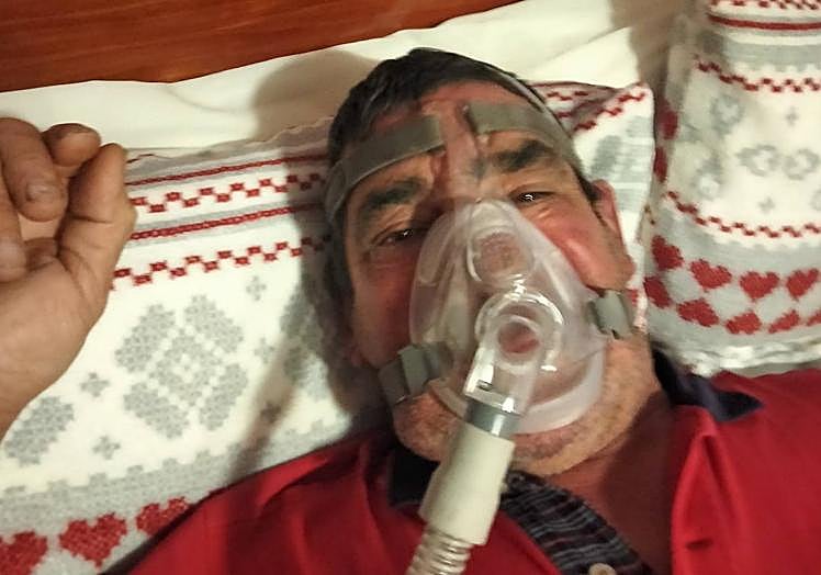 Teodoro debe colocarse todas las noches esta máscara.