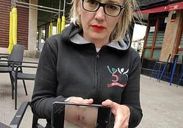 Victoria Eugenia Bustillo muestra una foto de las heridas que le causó un perro de raza Malinois.