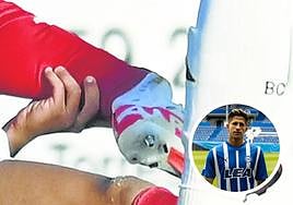 Una brutal entrada de un jugador del Burgos parte el peroné a Simeone