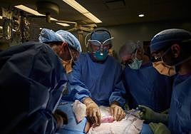 Un equipo de cirujanos trasplanta el riñón de un cerdo a una mujer. Ocurrió en 2021.
