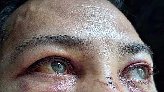 El juez envía a prisión preventiva al detenido por la paliza de Irala