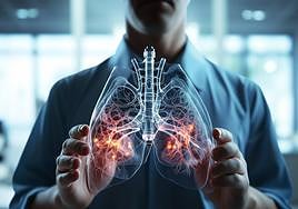 Un especialista muestra el aspecto de unos pulmones dañados por la tuberculosis.