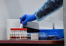 Test de coronavirus.