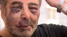 Valentín, de 58 años, fue brutalmente agredido después de pedir que hicieran menos ruido