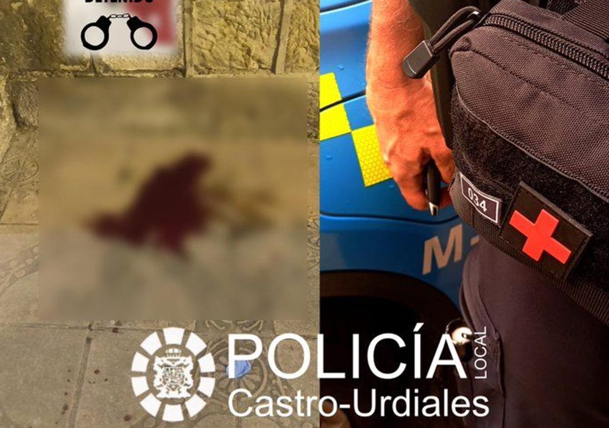 Trasladan a Cruces a un joven apuñalado en Castro esta madrugada