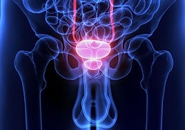 Euskadi se conjura contra el cáncer de próstata