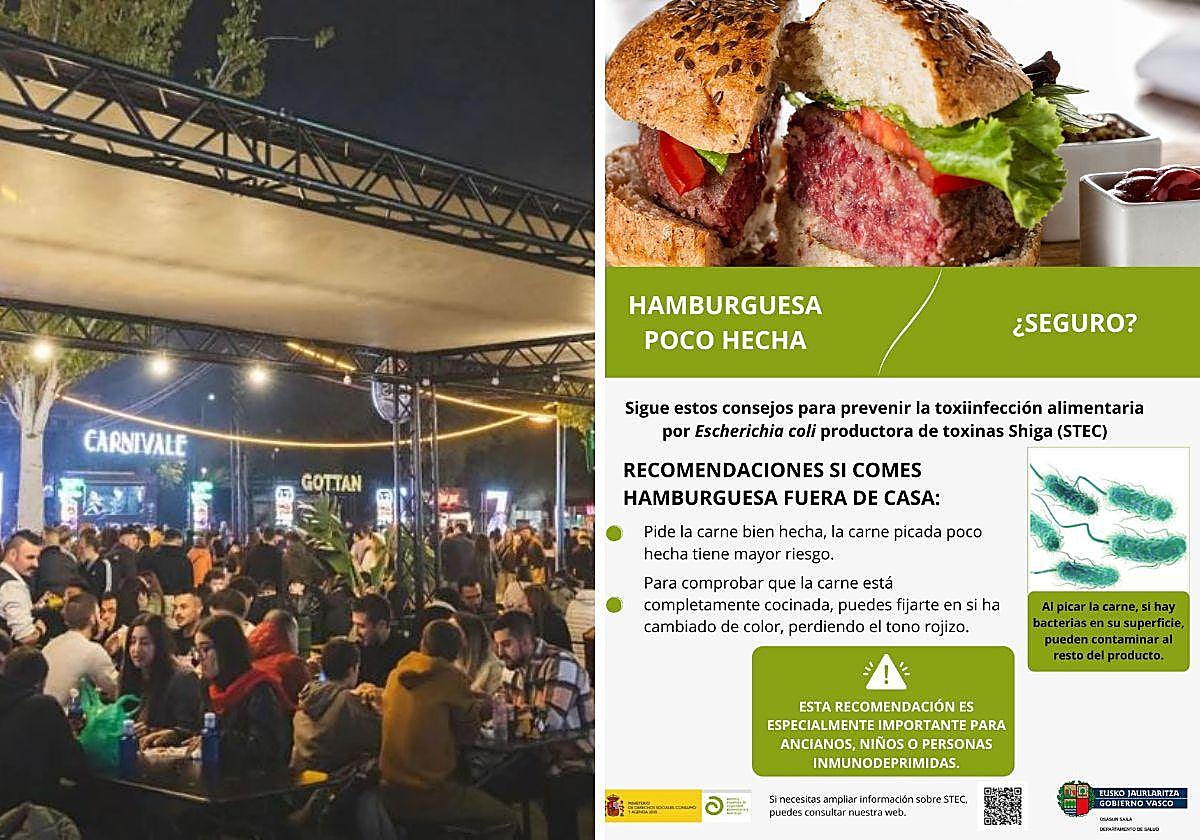 El aviso de Osakidetza para prevenir intoxicaciones alimentarias en la 'Champions Burger' de Barakaldo