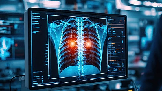 IA que lee radiografías, el 'segundo par de ojos' que revoluciona las urgencias