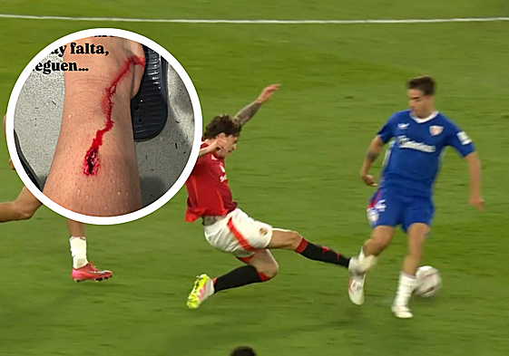 Prados muestra la herida sangrante por la dura entrada de Lindelof: «No hay falta, jueguen...»