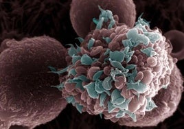 Identifican una nueva proteína para poder prevenir el cáncer de mama