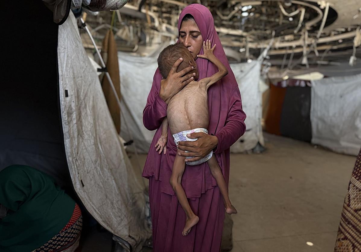 El pequeño gazatí Mohamed Motawaq, de tan solo 18 meses, pasa los días en Gaza en brazos de su madre, sin apenas leche y otros productos básicos por las restricciones de Israel.