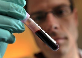 Un simple análisis de sangre puede alertar de la presencia de tumores en sus fases más tempranas.