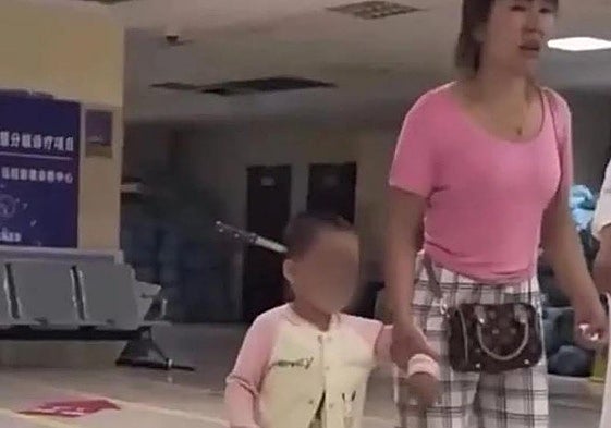 Una madre clava un cuchillo accidentalmente en la cabeza a su hija de 3 años y la lleva al hospital caminando