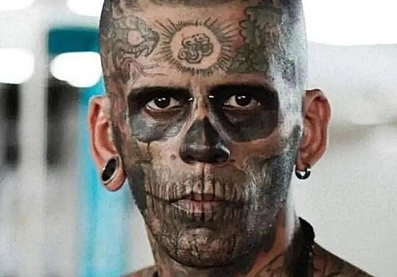 Leandro de Souza, antes de sus tratamientos