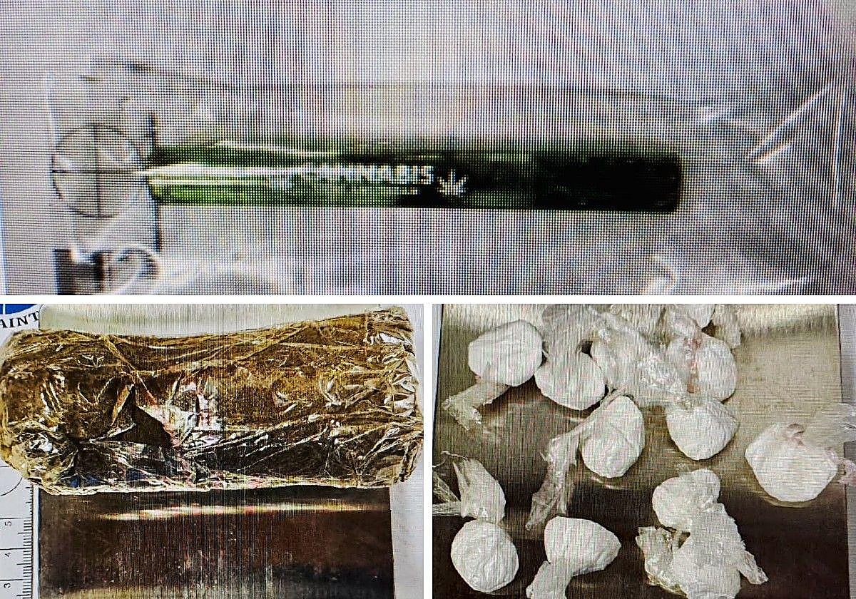 Varios de los objetos que hallaron en el interior del cuerpo del interno de Martutene.