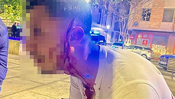 Detenido por rajar en la cara a otra persona con una botella durante una pelea de madrugada en Bilbao