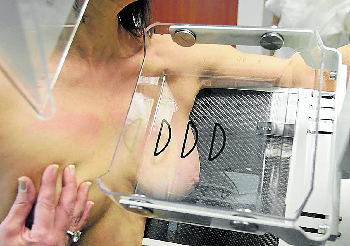 Una mujer se somete a una mamografía